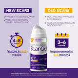 Silicone Scar Gel Scar Cream: SPF 30 Advanced Medical-Grade Formula for Surgical Scars, C-Section, Stretch Marks, Acne, Burns, Keloids, Old & New Scars – Broad Spectrum UV Protection 1.06oz (30g)