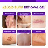 Keloid Bump Gel, Scar Prevention, Skin Renewal, Advanced Silicone Keloid Cream for Piercing Bumps 0.71 oz (1 Pack)