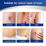 MURASAKI BEAUTY Silicone Scar Tape & Sheets – Removal on Keloids, Burns, Abrasion, C-Section, And Surgical Scars – Safe For Adults And Children – 1.6"X 60" Roll-4 X 1.5M(Pack of 1) (1.6X60inch)