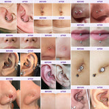 Free Keloid Bump Gel, Scar Prevention, Skin Renewal, Advanced Silicone Keloid Cream for Piercing Bumps 0.71 oz (1 Pack)