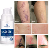 100% Silicone Scar Gel, Advanced Scar Gel for Surgical Scars, C-Section, Stretch Marks, Acne, Injury, Burns, Keloids, Hypertrophic, Old and New Scars 1.06oz(30g)